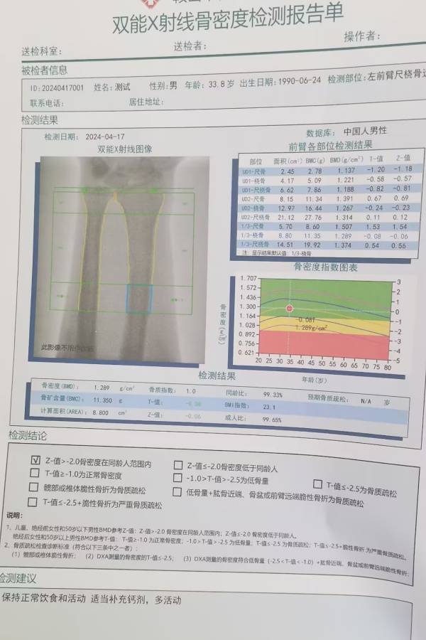 雙能X射線骨密度儀：準(zhǔn)確測(cè)量骨密度，助力骨質(zhì)疏松防治，守護(hù)骨骼健康